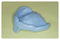 精密な型採り (精密印象)