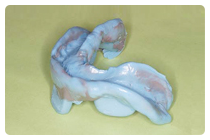 精密な型採り (精密印象)