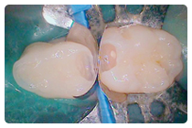 隔壁をセットした状態